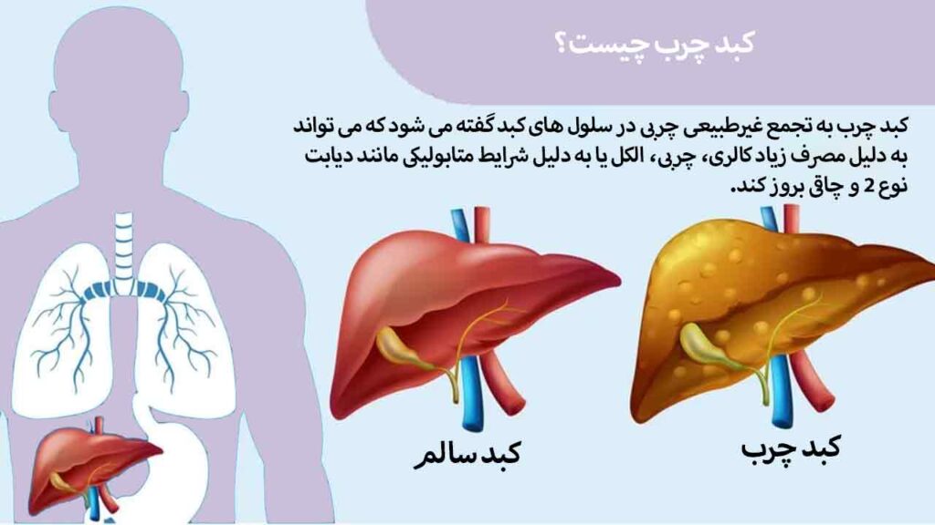 کبد چرب چیست؟