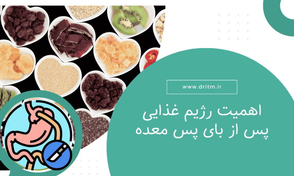 اهمیت رژیم غذایی پس از بای پس معده