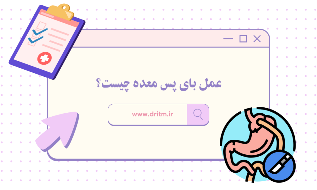 عمل بای پس معده چیست؟