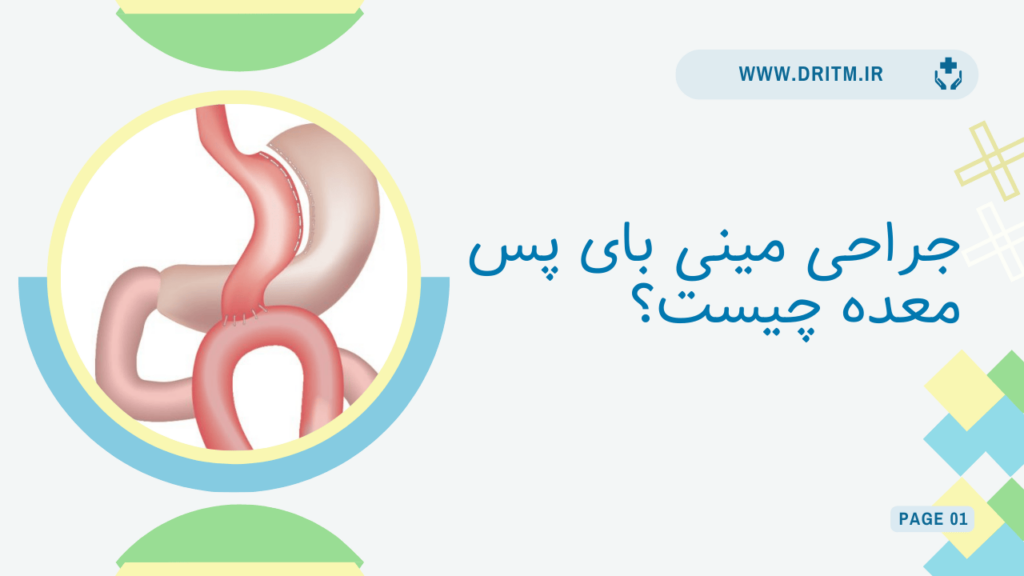 جراحی مینی بای پس معده چیست؟