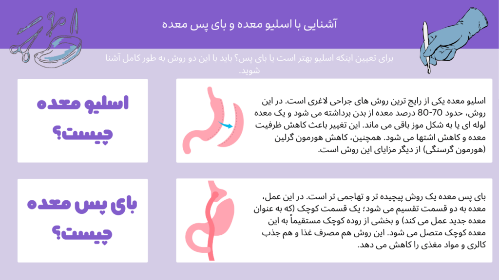 اسلیو معده و بای پس معده