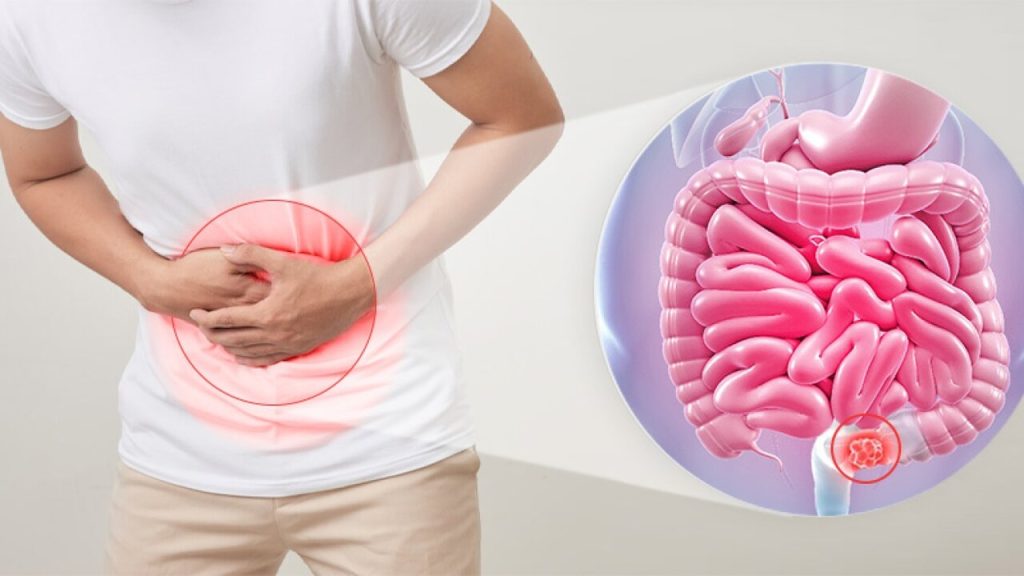 پیشنهادهای نوین در درک علل یبوست مزمن و نقش محور روده و مغز